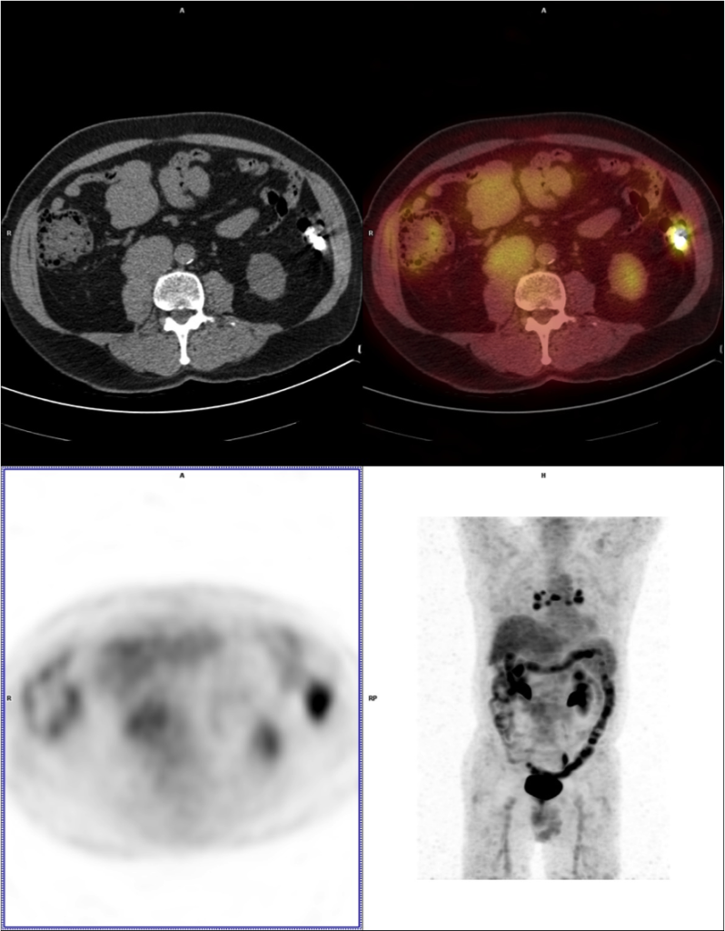 pet ct principle radiology
